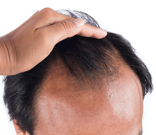 Generic placeholder image